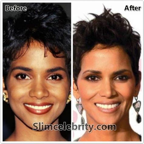 halle berry nose job|Halle Berry: Before and After